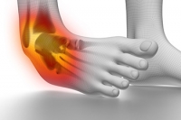 What Causes Chronic Ankle Instability?